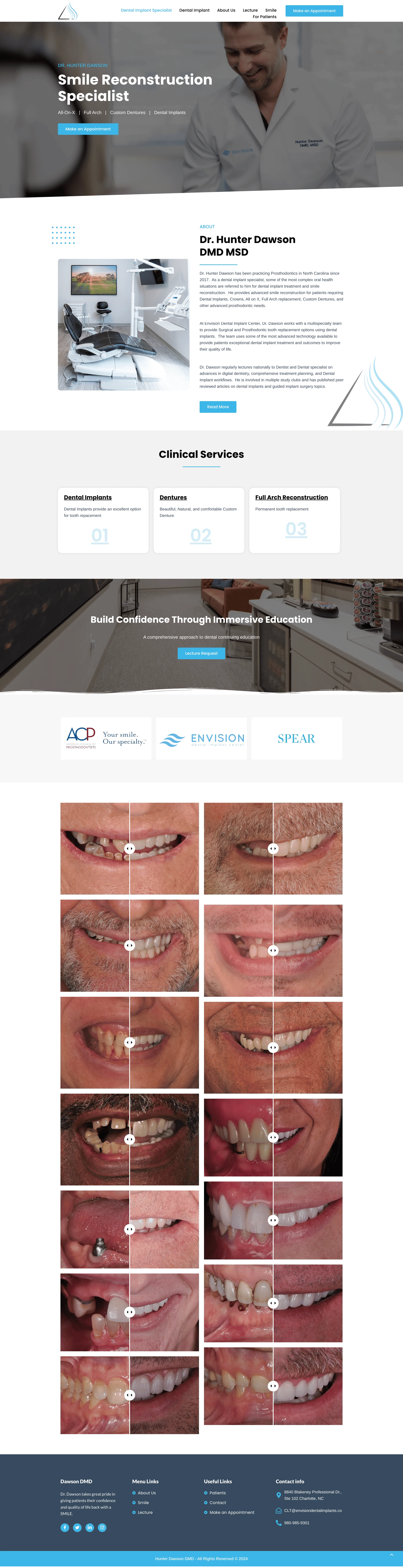 Dental Implant Specialist